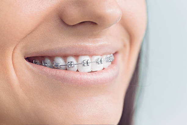 Best Oral Cancer Screening  in Auburn, IN